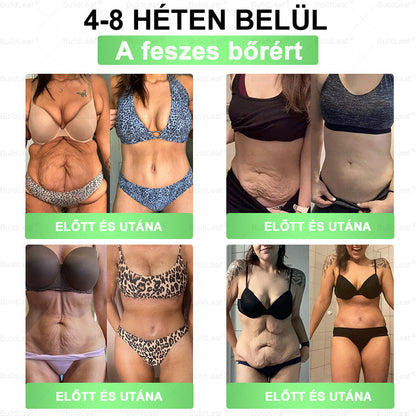 𝐁𝐮𝐢𝐥𝐝𝐋𝐞𝐚𝐟® 𝐆𝐋𝐏-𝟏 𝟖-𝐢𝐧-𝟏 𝐒𝐥𝐢𝐦 & 𝐇𝐞𝐚𝐥𝐭𝐡𝐲 𝐎𝐫á𝐥𝐢𝐬 𝐌𝐞𝐠𝐨𝐥𝐝á𝐬 💚🌿 🌿𝐓á𝐦𝐨𝐠𝐚𝐭𝐣𝐚 𝐚𝐳 𝐞𝐥𝐡í𝐳á𝐬 𝐤𝐞𝐳𝐞𝐥é𝐬é𝐭, 𝐚 𝐬𝐳í𝐯- é𝐬 é𝐫𝐫𝐞𝐧𝐝𝐬𝐳𝐞𝐫𝐢 𝐞𝐠é𝐬𝐳𝐬é𝐠𝐞𝐭, 𝐚 𝐜𝐮𝐤𝐨𝐫𝐛𝐞𝐭𝐞𝐠𝐬é𝐠𝐞𝐭, 𝐚𝐳 𝐚𝐥𝐯á𝐬𝐢 𝐚𝐩𝐧𝐨é𝐭, 𝐚 𝐛é𝐥𝐫𝐞𝐧𝐝𝐬𝐳𝐞𝐫 𝐞𝐠é𝐬𝐳𝐬é𝐠é𝐭, 𝐦𝐢𝐤ö𝐳𝐛𝐞𝐧 𝐟𝐞𝐬𝐳𝐞𝐬í𝐭𝐢 𝐚 𝐛ő𝐫𝐭 é𝐬 𝐧ö𝐯𝐞𝐥𝐢 𝐚𝐳 𝐞𝐧𝐞𝐫𝐠𝐢á𝐭.✅