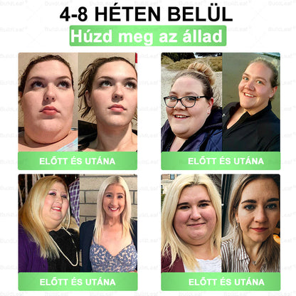 𝐁𝐮𝐢𝐥𝐝𝐋𝐞𝐚𝐟® 𝐆𝐋𝐏-𝟏 𝟖-𝐢𝐧-𝟏 𝐒𝐥𝐢𝐦 & 𝐇𝐞𝐚𝐥𝐭𝐡𝐲 𝐎𝐫á𝐥𝐢𝐬 𝐌𝐞𝐠𝐨𝐥𝐝á𝐬 💚🌿 🌿𝐓á𝐦𝐨𝐠𝐚𝐭𝐣𝐚 𝐚𝐳 𝐞𝐥𝐡í𝐳á𝐬 𝐤𝐞𝐳𝐞𝐥é𝐬é𝐭, 𝐚 𝐬𝐳í𝐯- é𝐬 é𝐫𝐫𝐞𝐧𝐝𝐬𝐳𝐞𝐫𝐢 𝐞𝐠é𝐬𝐳𝐬é𝐠𝐞𝐭, 𝐚 𝐜𝐮𝐤𝐨𝐫𝐛𝐞𝐭𝐞𝐠𝐬é𝐠𝐞𝐭, 𝐚𝐳 𝐚𝐥𝐯á𝐬𝐢 𝐚𝐩𝐧𝐨é𝐭, 𝐚 𝐛é𝐥𝐫𝐞𝐧𝐝𝐬𝐳𝐞𝐫 𝐞𝐠é𝐬𝐳𝐬é𝐠é𝐭, 𝐦𝐢𝐤ö𝐳𝐛𝐞𝐧 𝐟𝐞𝐬𝐳𝐞𝐬í𝐭𝐢 𝐚 𝐛ő𝐫𝐭 é𝐬 𝐧ö𝐯𝐞𝐥𝐢 𝐚𝐳 𝐞𝐧𝐞𝐫𝐠𝐢á𝐭.✅